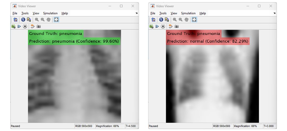 Two X-rays showing correct and incorrect pneumonia predictions with confidence scores.