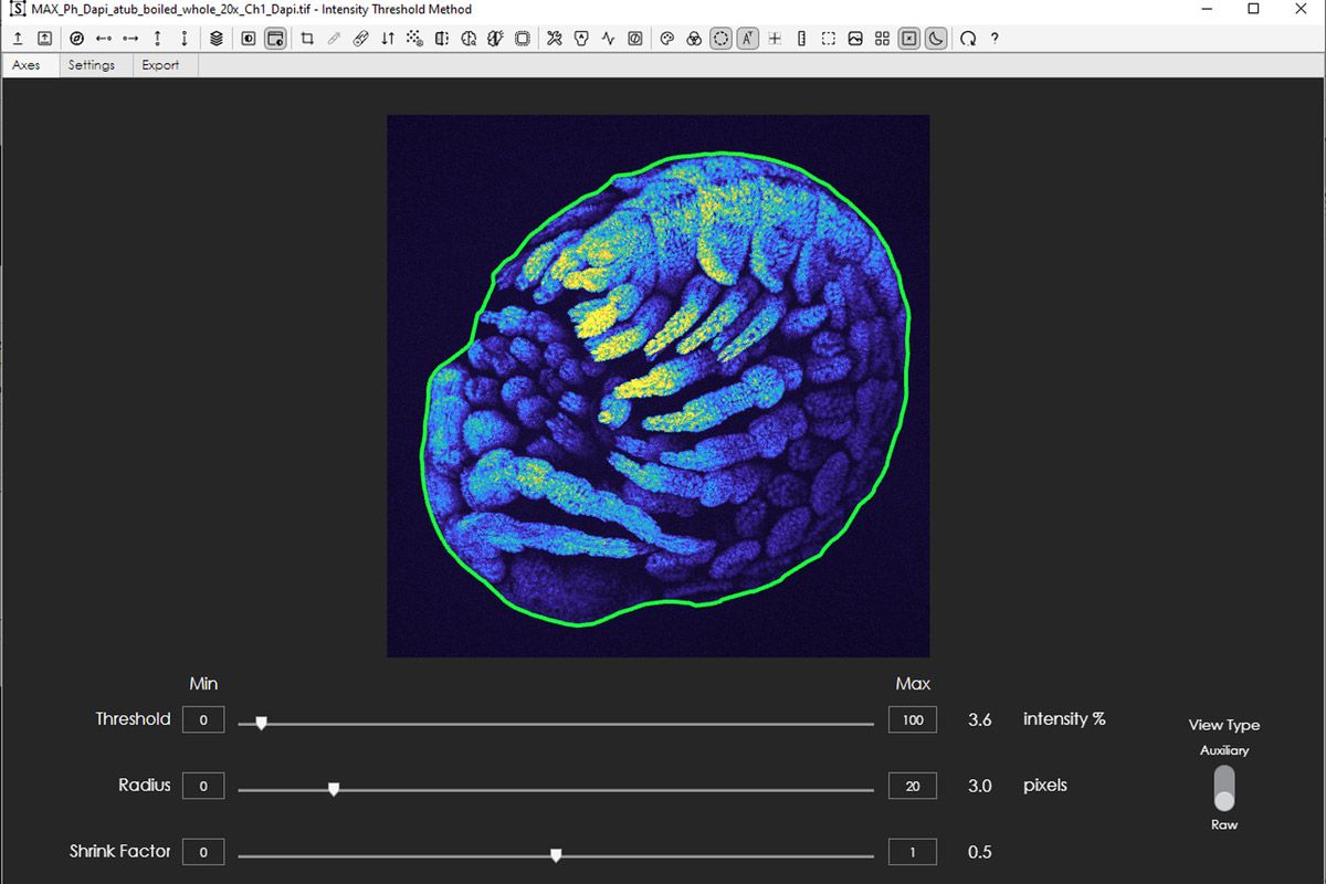 The user interface of the tool showing the adjustments for threshold, radius, and shrink factor.