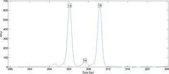 Figure 1. DNA data showing two peaks from which an individual’s (13, 15) genotype can be inferred.