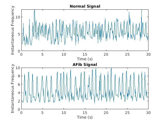 正常和房颤的瞬时频率图