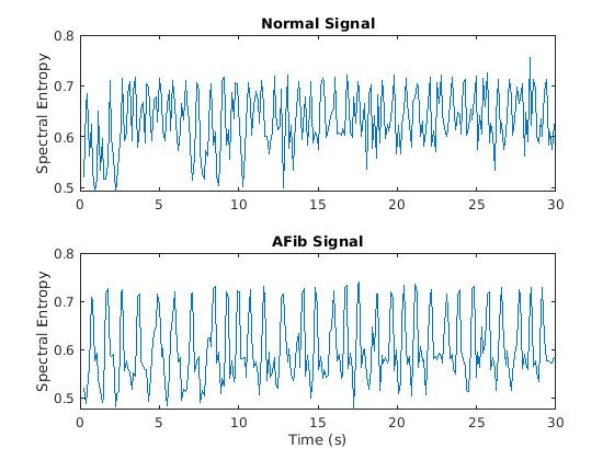 正常和房颤的频谱熵图