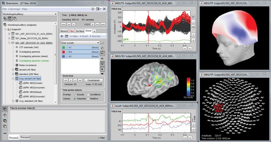 MATLAB_in_World_brain_w.jpg