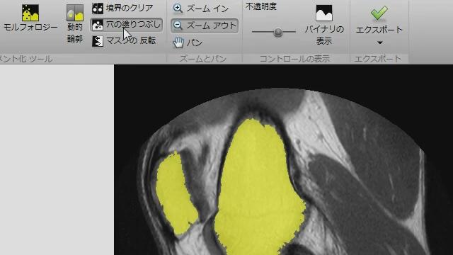 画像内の特定の物体領域に対しイメージの領域分割アプリケーションを使用することで、輝度情報を基にした領域分割を効率よく行う方法をご紹介します。