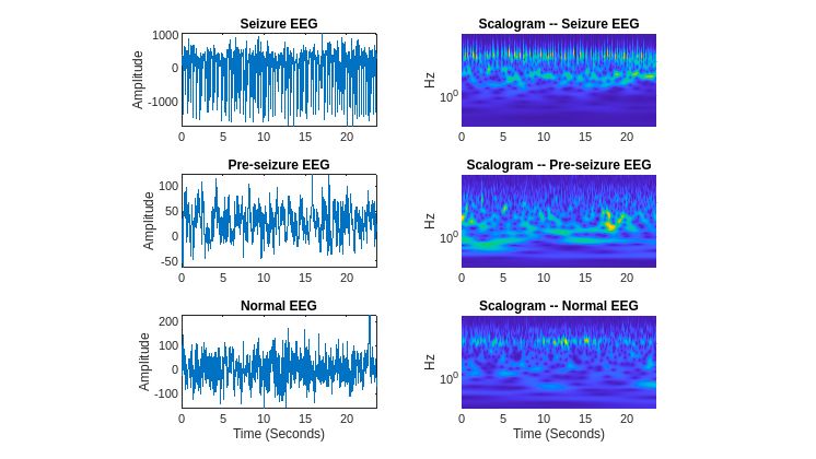 Classifying EEG data with a time-frequency convolutional network.