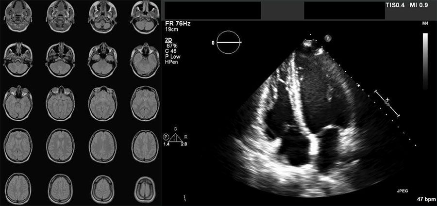 Examples of DICOM-formatted images: a series of 20 images from a brain MRI scan and a cardiac ultrasound image.
