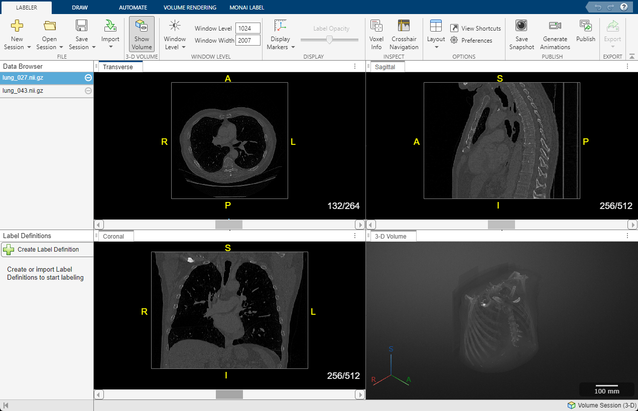 Screenshot showing transverse, sagittal, coronal, and 3-D volume DICOM images of a chest CT scan with labels.