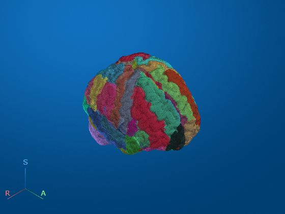 An application of medical AI showing 3D brain MRI segmented into several regions using different colors.