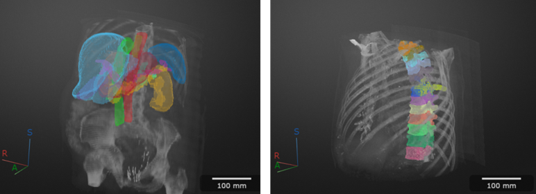 A medical AI application showing segmentation and labeling of internal organs in 3D scans of a torso.