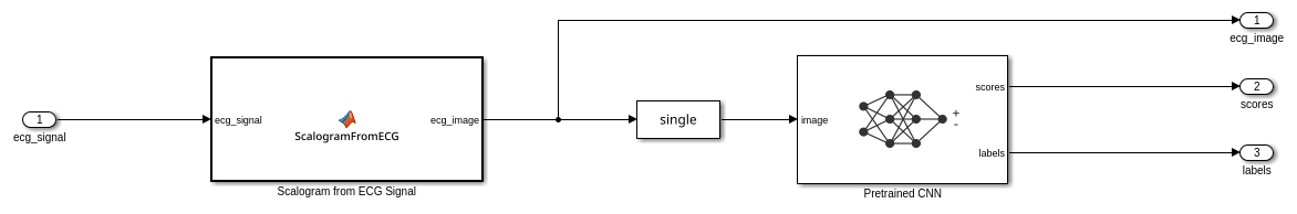 Classify ECG Signals in Simulink Using Deep Learning