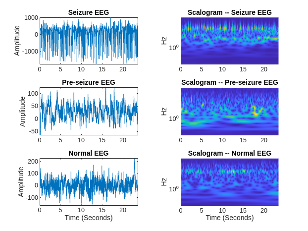 Time-Frequency Convolutional Network for EEG Data Classification