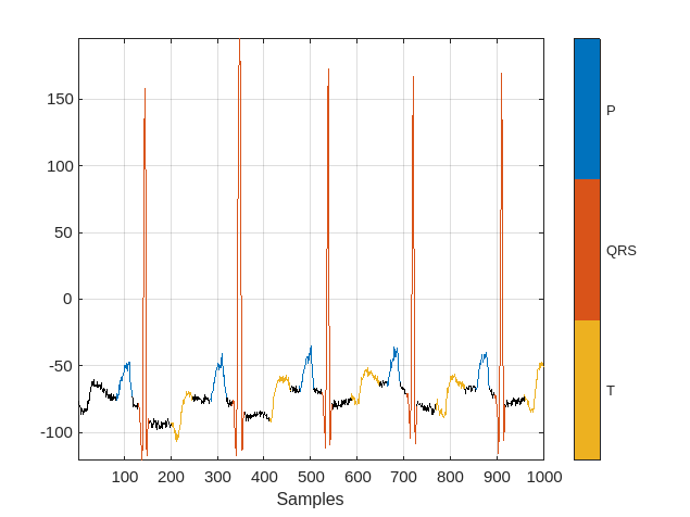 Waveform Segmentation Using Deep Learning