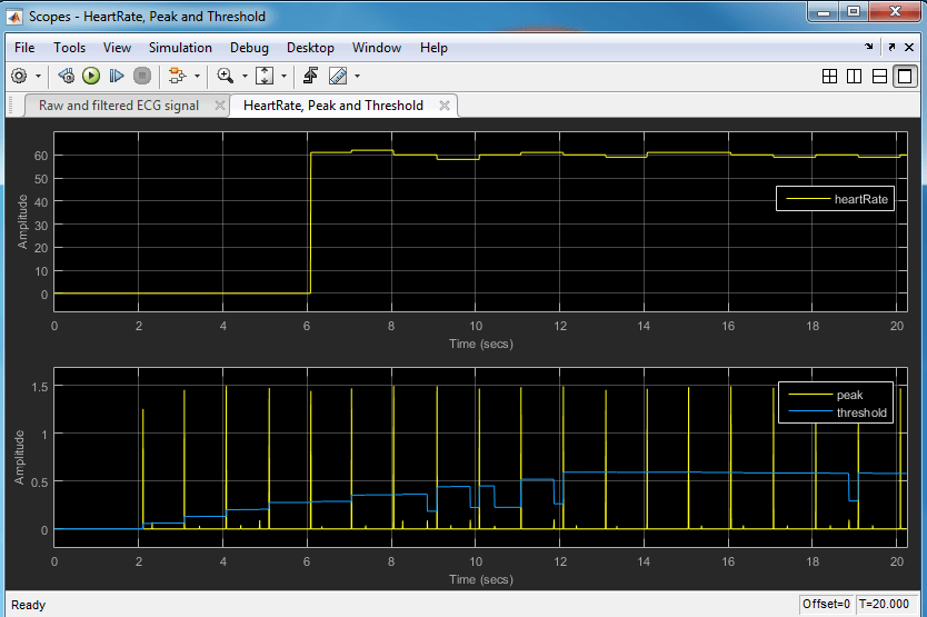 Real-Time ECG QRS Detection