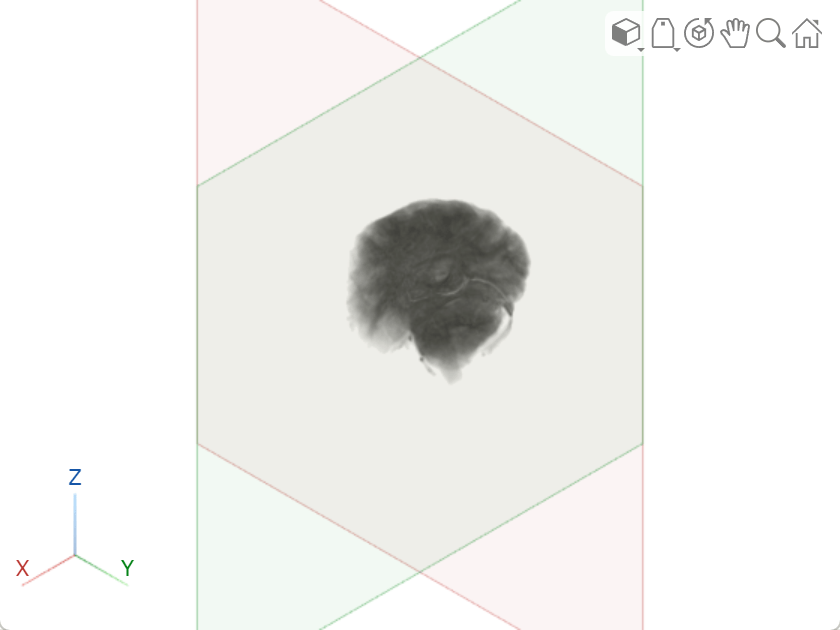 Viewer window, showing the effect of adding a second clipping plane. Only one quadrant of the brain is visible.