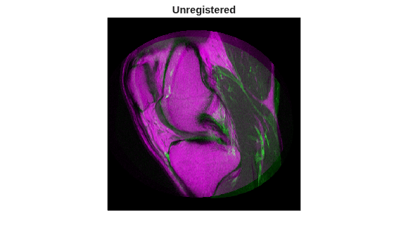 Figure contains an axes object. The hidden axes object with title Unregistered contains an object of type image.