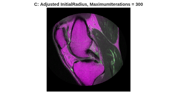 Figure contains an axes object. The hidden axes object with title C: Adjusted InitialRadius, MaximumIterations = 300 contains an object of type image.