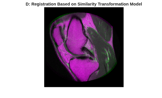 Figure contains an axes object. The hidden axes object with title D: Registration Based on Similarity Transformation Model contains an object of type image.