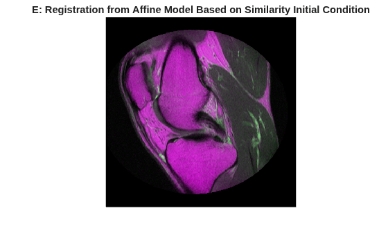 Figure contains an axes object. The hidden axes object with title E: Registration from Affine Model Based on Similarity Initial Condition contains an object of type image.