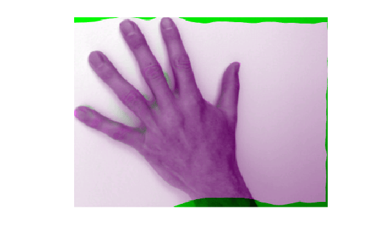 Figure contains an axes object. The hidden axes object contains an object of type image.
