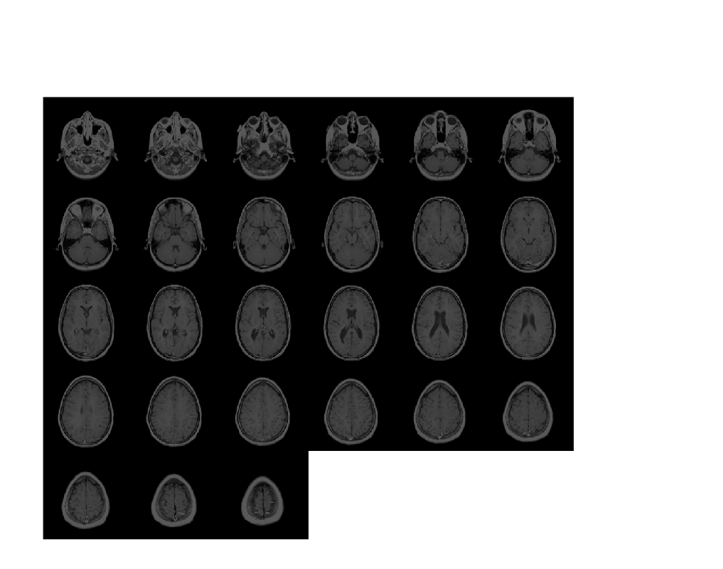 Figure contains an axes object. The hidden axes object contains an object of type image.