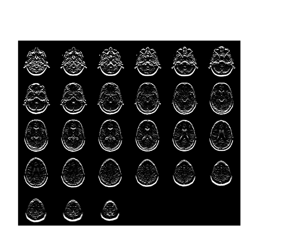 Figure contains an axes object. The hidden axes object contains an object of type image.