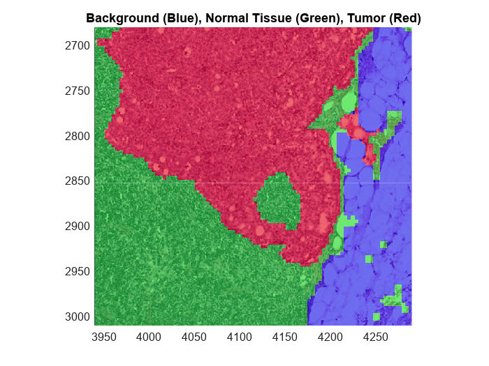 Figure contains an axes object. The axes object with title Background (Blue), Normal Tissue (Green), Tumor (Red) contains an object of type bigimageshow.