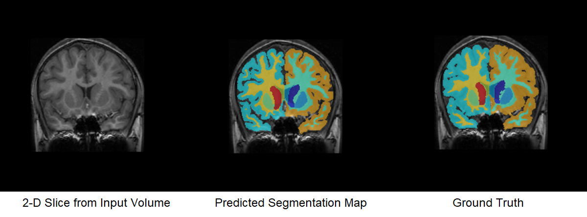 Comparison of Predicted Segmentation Map and Ground Truth Segmentation Map