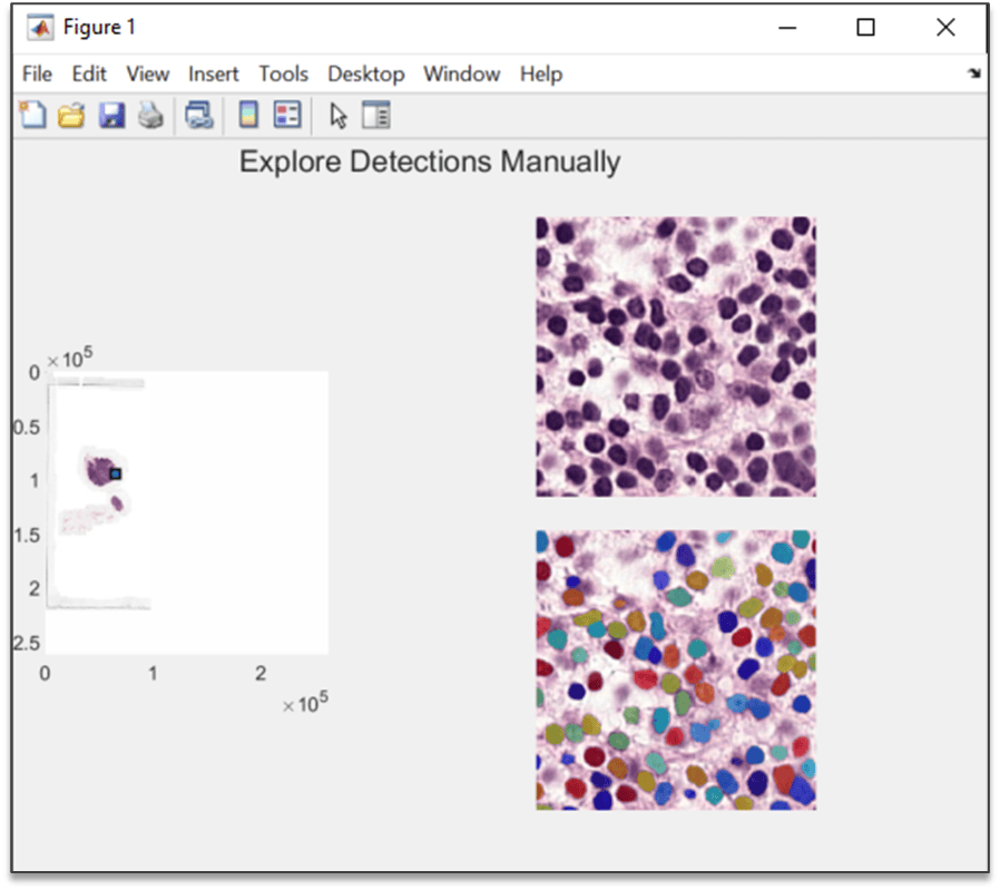 Interactive window to explore labels across the WSI