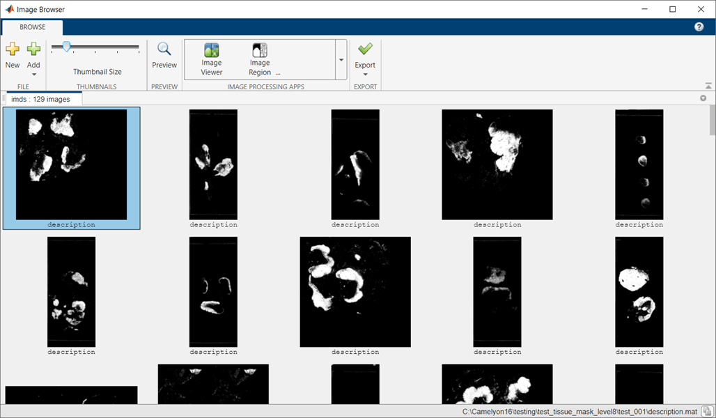 ImageBrowser_testing_tissue.png