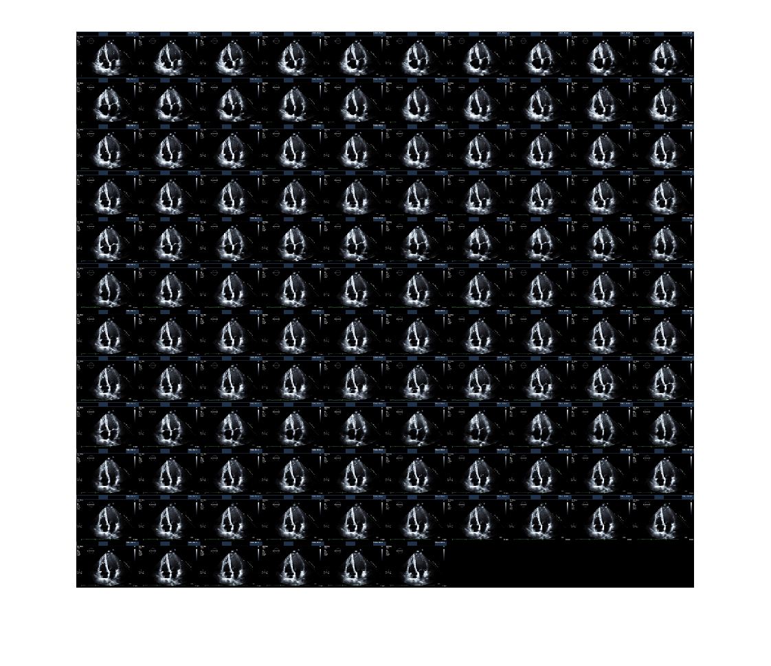 Figure contains an axes object. The hidden axes object contains an object of type image.