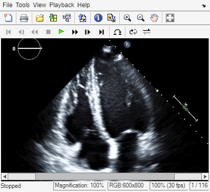 Figure Movie Player contains an axes object and other objects of type uigridlayout, uimenu, uitoolbar. The hidden axes object contains an object of type image.