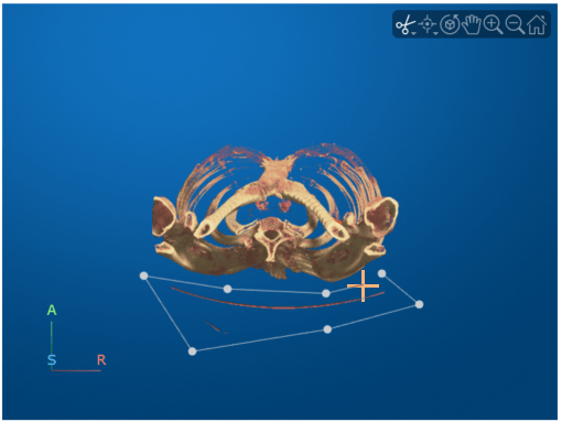 Viewer window showing drawn polygon around the bed region to remove