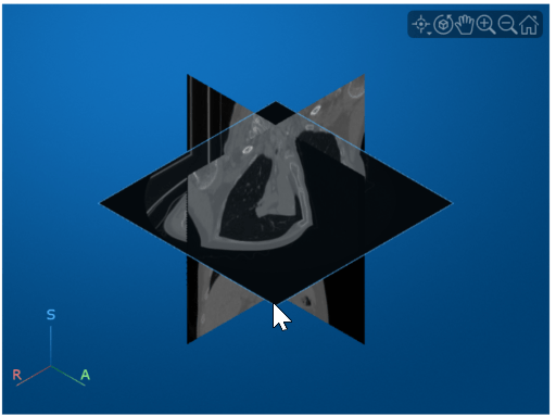 Viewer window showing the cursor paused on the transverse slice, which highlights in blue