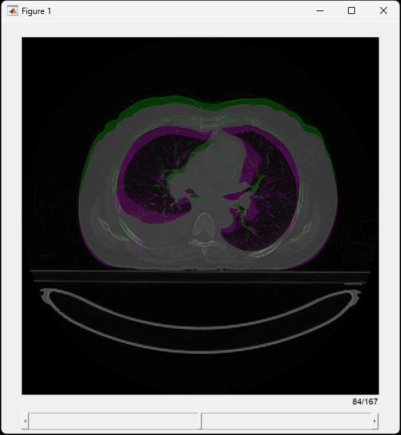 Scrollable sliceViewer window showing the transverse slices of a fused overlay of the unregistered volumes.