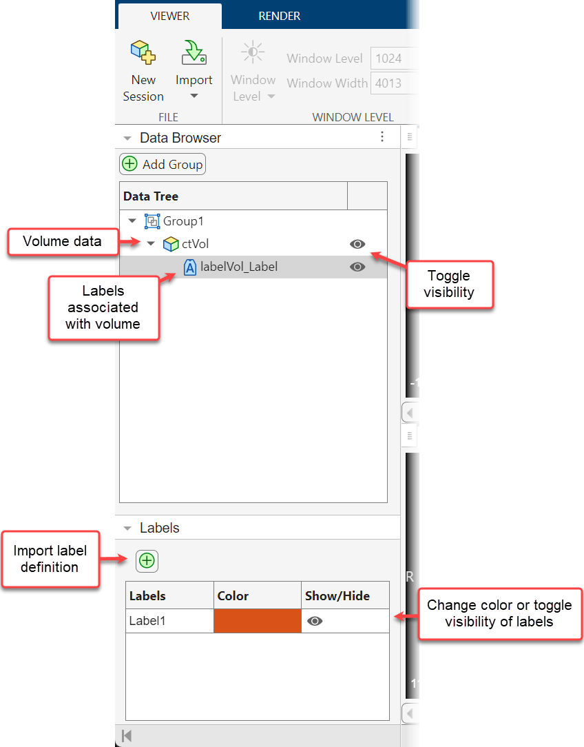 Medical Volume Viewer app window showing the Data Browser and Labels panes with options for viewing, hiding, and organizing data