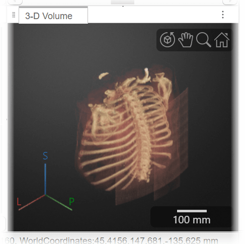 3-D display pane after changing the rendering technique to Gradient Opacity