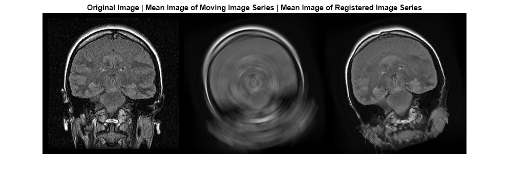 Figure contains an axes object. The hidden axes object with title Original Image | Mean Image of Moving Image Series | Mean Image of Registered Image Series contains an object of type image.