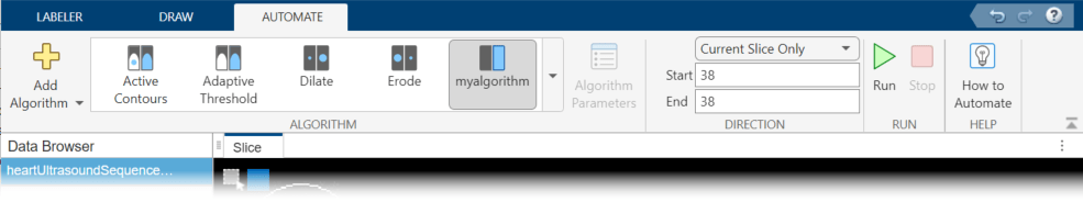 Manually Interpolate dialog box for selecting the label regions and slices for interpolation