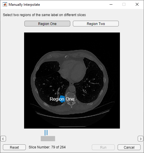 Select drawn tumor region to perform interpolation