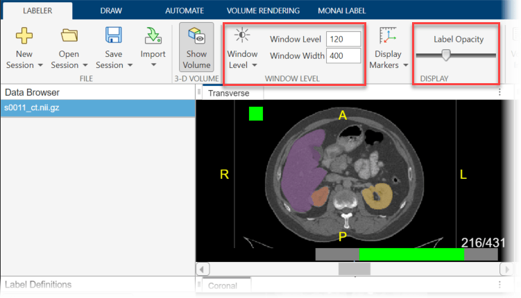 Label Definitions pane with the new lung_left and lung_right labels.