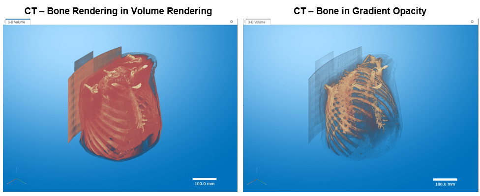 Side-by-side comparison of the 3-D volume display using the volume rendering versus gradient opacity rendering styles