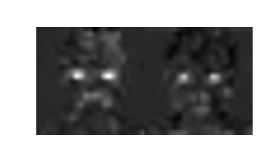 Figure contains an axes object. The hidden axes object contains an object of type image.