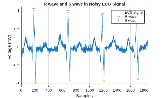 Figure contains an axes object. The axes object with title R wave and S wave in Noisy ECG Signal, xlabel Samples, ylabel Voltage (mV) contains 3 objects of type line. One or more of the lines displays its values using only markers These objects represent ECG Signal, R wave, S wave.