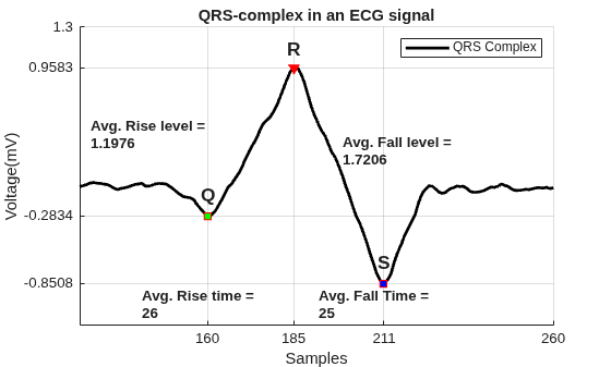 Figure contains an axes object. The axes object with title QRS-complex in an ECG signal, xlabel Samples, ylabel Voltage(mV) contains 11 objects of type line, text. One or more of the lines displays its values using only markers These objects represent QRS Complex, Peak, Minima.