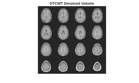 Figure contains an axes object. The hidden axes object with title DTCWT Denoised Volume contains an object of type image.