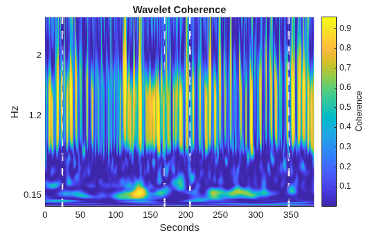 Wavelet Analysis of Physiologic Signals