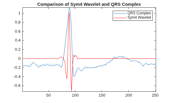 R Wave Detection in the ECG