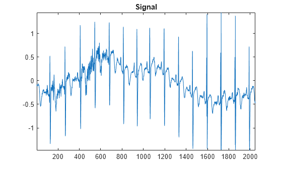 Figure contains an axes object. The axes object with title Signal contains an object of type line.