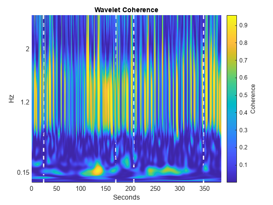 Wavelet Analysis of Physiologic Signals