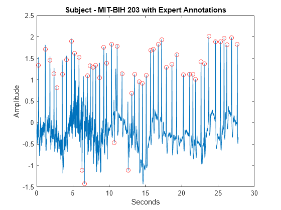 Figure contains an axes object. The axes object with title Subject - MIT-BIH 203 with Expert Annotations, xlabel Seconds, ylabel Amplitude contains 2 objects of type line. One or more of the lines displays its values using only markers