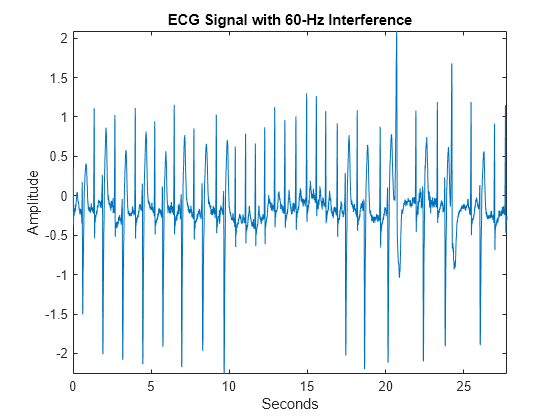 Figure contains an axes object. The axes object with title ECG Signal with 60-Hz Interference, xlabel Seconds, ylabel Amplitude contains an object of type line.